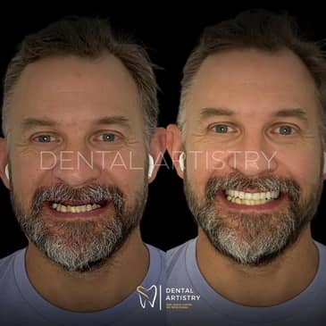 Slider image (10) Dental Artistry Dental Center